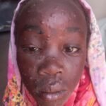 26 منظمة حقوقية و منصة إعلامية تطالب بإعلان جبل مرة منطقة وباء